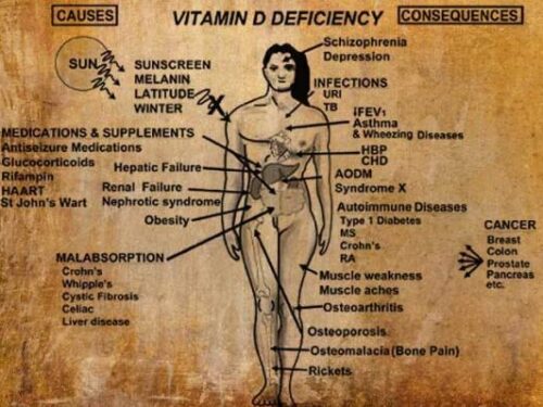 I 7 segni della vitamina D bassa  Patologie legate strettamente alla carenza di Vitamina D