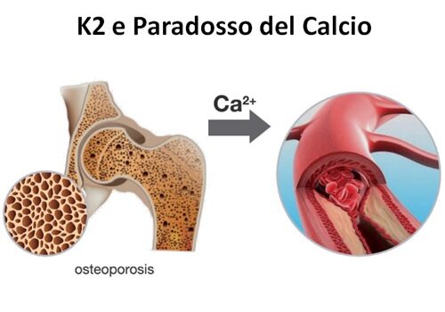 Vitamina K2: il nutriente mancante per il cuore e le ossa