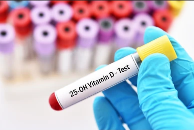 I due Test della vitamina DQuando fare 25(OH) o 1,25(OH)