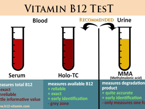 Vitamina B12: Scopri se sei a rischio di carenza  Quali esami?